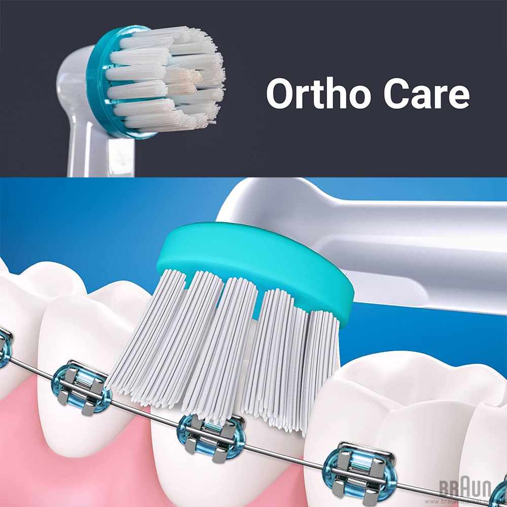 ارتودنسی و مسواک برقی؛ آیا استفاده از آن توصیه میشود؟ 3 ارتودنسی و مسواک برقی؛ آیا استفاده از آن توصیه میشود؟