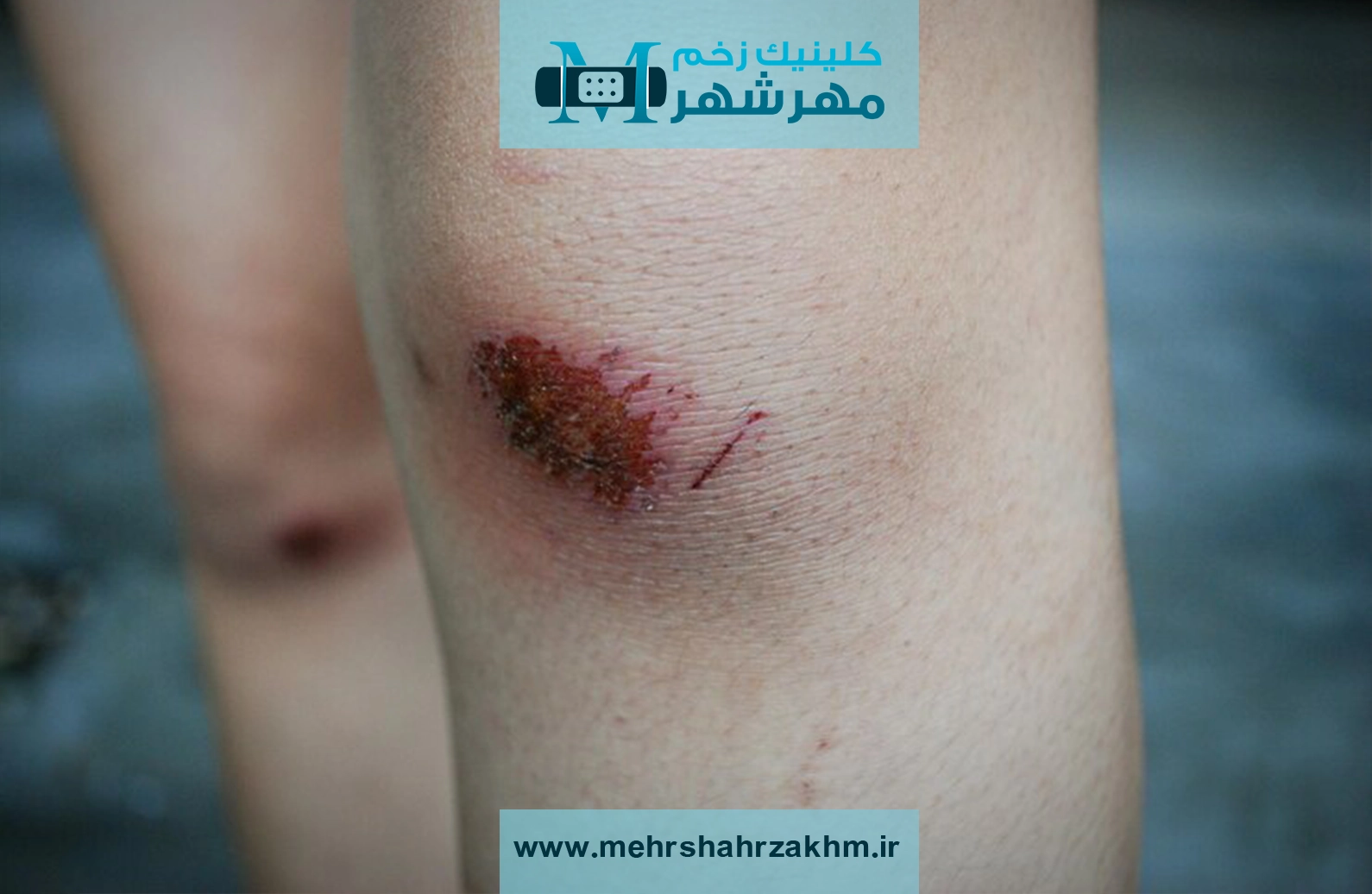 RDmL97DrCV7lz2ifkqbKK93DYebkIGFUPC22VzBN