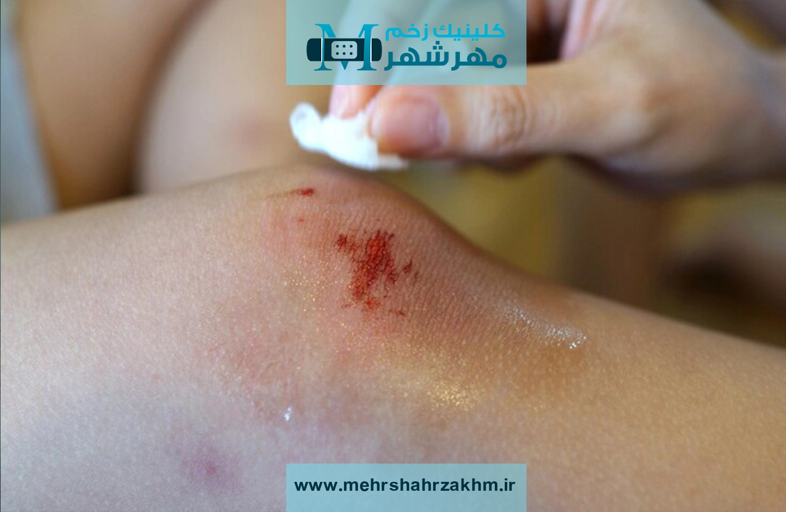 VBuloE3TXy9prpIrwfjk5gEyKfc976m3NwAPgHub