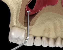 gL8LXxUnnEo3PJIsyNOoaZvGSxrrMk99CI4f6crO