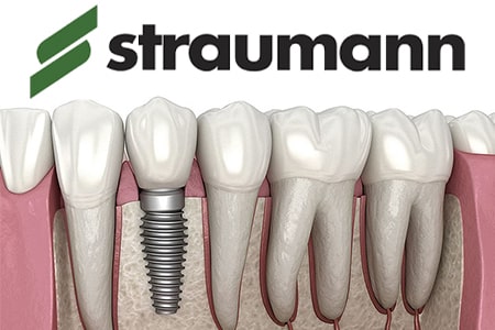 straumann implant 1