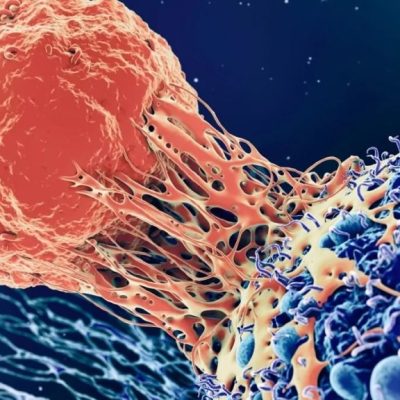 مرگ ناشی از سرطان