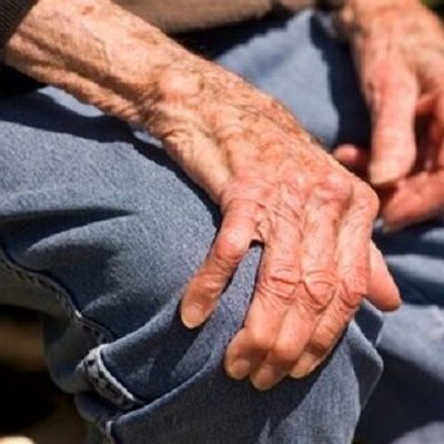 سراستادیار مرکز تحقیقات استئوپروز دانشگاه علوم پزشکی تهران وضعیت پوکی استخوان در ایران را شرح داد
