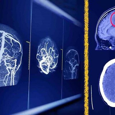 تحلیل تأثیر هوش مصنوعی بر آیندهٔ رادیولوژی سه سناریوی پیشروی