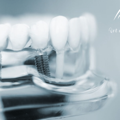 مرکز تخصصی ایمپلنت آرت دنتال در فرمانیه
