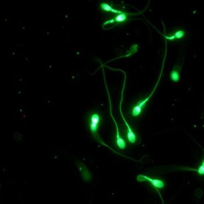 استفاده بیشتر از موبایل با کاهش تعداد اسپرم رابطه دارد