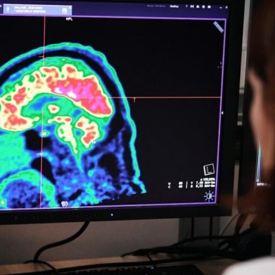 برای اولین‌بار تومور مرگبار نوجوانی 13 ساله درمان شد