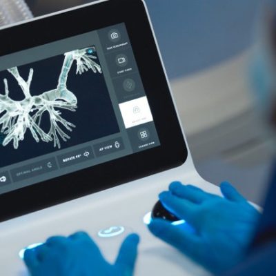 برونکوسکوپی ریه روشی برای تشخیص مشکلات ریوی و مجاری تنفسی